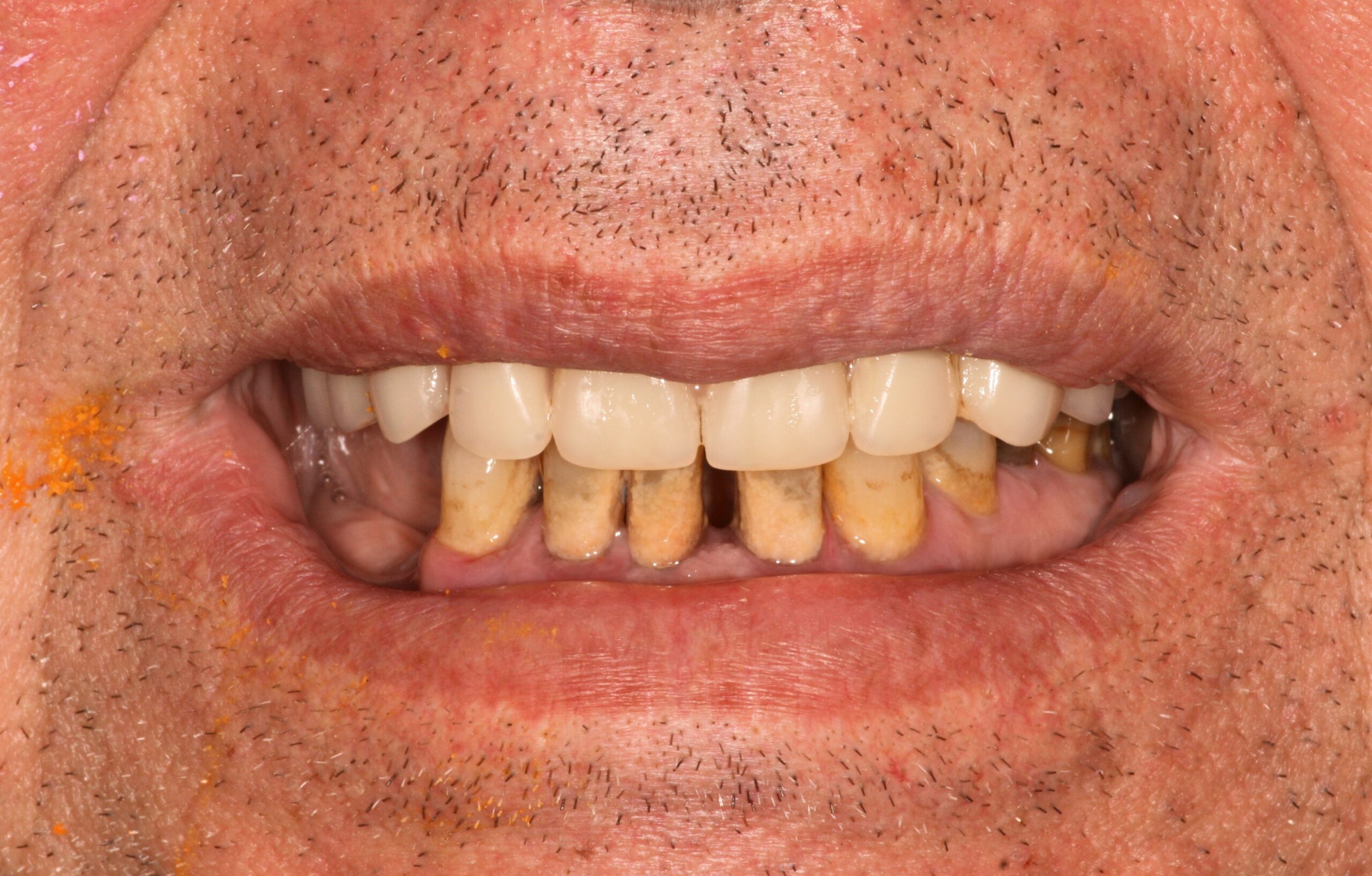 Αρχική κατάσταση